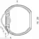 Fig. 27 - Ab externo intraocular shunt placement