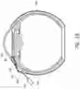Fig. 28 - Ab externo intraocular shunt placement