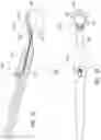 Fig. 30 - Ab externo intraocular shunt placement
