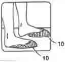 Fig. 01 - FOOT THERAPY DEVICE