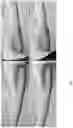 Fig. 08 - Peptide compositions and methods for ameliorating skin laxity and body contour