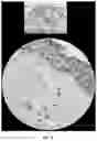 Fig. 13 - Peptide compositions and methods for ameliorating skin laxity and body contour