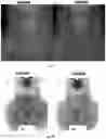 Fig. 15 - Peptide compositions and methods for ameliorating skin laxity and body contour
