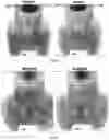 Fig. 16 - Peptide compositions and methods for ameliorating skin laxity and body contour
