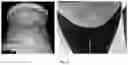 Fig. 20 - Peptide compositions and methods for ameliorating skin laxity and body contour