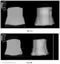 Fig. 23 - Peptide compositions and methods for ameliorating skin laxity and body contour