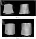 Fig. 24 - Peptide compositions and methods for ameliorating skin laxity and body contour