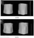 Fig. 25 - Peptide compositions and methods for ameliorating skin laxity and body contour