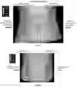 Fig. 26 - Peptide compositions and methods for ameliorating skin laxity and body contour