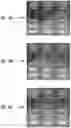 Fig. 10 - PHARMACEUTICAL FORMULATION AND SYSTEM AND METHOD FOR DELIVERY