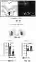 Fig. 02 - Method and pharmaceutical composition for treating depression