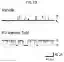 Fig. 21 - Composition for BKchannel activation