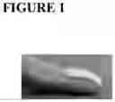 Fig. 02 - Topical pharmaceutical composition containing phenytoin and a (co-) analgesic for the treatment of chronic pain