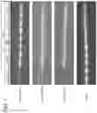 Fig. 10 - Compositions and methods of Rit1 inhibition
