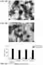 Fig. 02 - METHODS FOR TREATING INFECTION