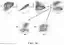 Fig. 31 - Oxabicycloheptanes for modulation of immune response