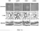 Fig. 36 - Oxabicycloheptanes for modulation of immune response
