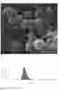 Fig. 02 - Calcium peroxides nanoparticles as adjuvant therapy
