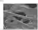 Fig. 04 - Pharmaceutical preparation and medical device