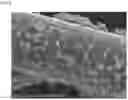 Fig. 05 - Pharmaceutical preparation and medical device