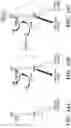Fig. 48 - METHODS AND COMPOSITIONS OF TREATING AUTOIMMUNE DISEASES