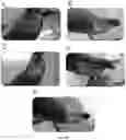Fig. 24 - Immunocompatible amniotic membrane products