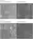 Fig. 01 - ROR1-POSITIVE MESENCHYMAL STEM CELL-CONTAINING PHARMACEUTICAL COMPOSITION FOR PREVENTING OR TREATING DISEASE ASSOCIATED WITH FIBROSIS, METHOD FOR PREPARING SAME, AND METHOD FOR PREVENTING OR TREATING DISEASE ASSOCIATED WITH FIBROSIS USING ROR1-POSITIVE MESENCHYMAL STEM CELLS