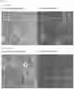 Fig. 15 - ROR1-POSITIVE MESENCHYMAL STEM CELL-CONTAINING PHARMACEUTICAL COMPOSITION FOR PREVENTING OR TREATING DISEASE ASSOCIATED WITH FIBROSIS, METHOD FOR PREPARING SAME, AND METHOD FOR PREVENTING OR TREATING DISEASE ASSOCIATED WITH FIBROSIS USING ROR1-POSITIVE MESENCHYMAL STEM CELLS