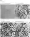 Fig. 16 - ROR1-POSITIVE MESENCHYMAL STEM CELL-CONTAINING PHARMACEUTICAL COMPOSITION FOR PREVENTING OR TREATING DISEASE ASSOCIATED WITH FIBROSIS, METHOD FOR PREPARING SAME, AND METHOD FOR PREVENTING OR TREATING DISEASE ASSOCIATED WITH FIBROSIS USING ROR1-POSITIVE MESENCHYMAL STEM CELLS