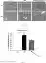 Fig. 02 - Method of ameliorating chronic kidney disease using 
