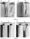 Fig. 03 - Probiotic compositions and uses thereof