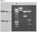 Fig. 02 - Gene therapy for ciliopathies