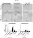 Fig. 09 - Collagen hydrolysates as a beneficial prebiotic and their effect on joint inflammation and osteoarthritis