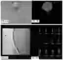 Fig. 03 - Inhibiting sprout angiogenesis