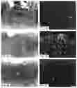 Fig. 04 - Inhibiting sprout angiogenesis