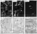 Fig. 05 - Inhibiting sprout angiogenesis