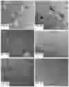 Fig. 06 - Inhibiting sprout angiogenesis