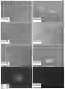 Fig. 07 - Inhibiting sprout angiogenesis