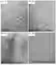 Fig. 08 - Inhibiting sprout angiogenesis