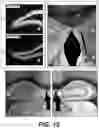 Fig. 14 - BRAIN OSTEOCALCIN RECEPTOR AND COGNITIVE DISORDERS