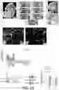 Fig. 18 - BRAIN OSTEOCALCIN RECEPTOR AND COGNITIVE DISORDERS