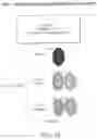 Fig. 11 - COMPOSITIONS AND METHODS OF IDENTIFYING TUMOR SPECIFIC NEOANTIGENS