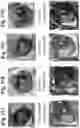 Fig. 38 - Compositions and methods for enhancing innate immunity in a subject for treatment of infections and cancer and other acute and chronic conditions of the eye