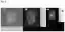 Fig. 04 - COLLAGEN MATERIAL AND METHOD FOR PRODUCING COLLAGEN MATERIAL