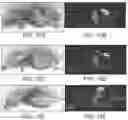 Fig. 11 - Cartilage-homing peptide conjugates and methods of use thereof