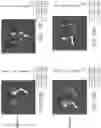 Fig. 15 - Cartilage-homing peptide conjugates and methods of use thereof
