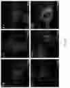 Fig. 16 - Peptidic self-assembly for nucleic acid delivery