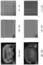 Fig. 25 - MRI IMAGING OF AMYLOID PLAQUE USING LIPOSOMES