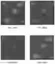 Fig. 26 - MRI IMAGING OF AMYLOID PLAQUE USING LIPOSOMES