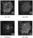 Fig. 27 - MRI IMAGING OF AMYLOID PLAQUE USING LIPOSOMES
